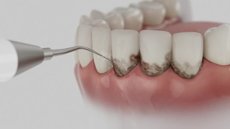 Trusted Teeth Cleaning And Checkup service in Jacksonville, AL - Dentist Open Now